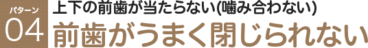 上下の前歯が当たらない(噛み合わない) 前歯がうまく閉じられない