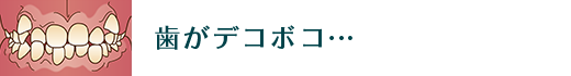 歯がデコボコ…